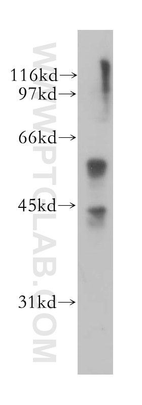 WB analysis of HEK-293 using 13085-1-AP