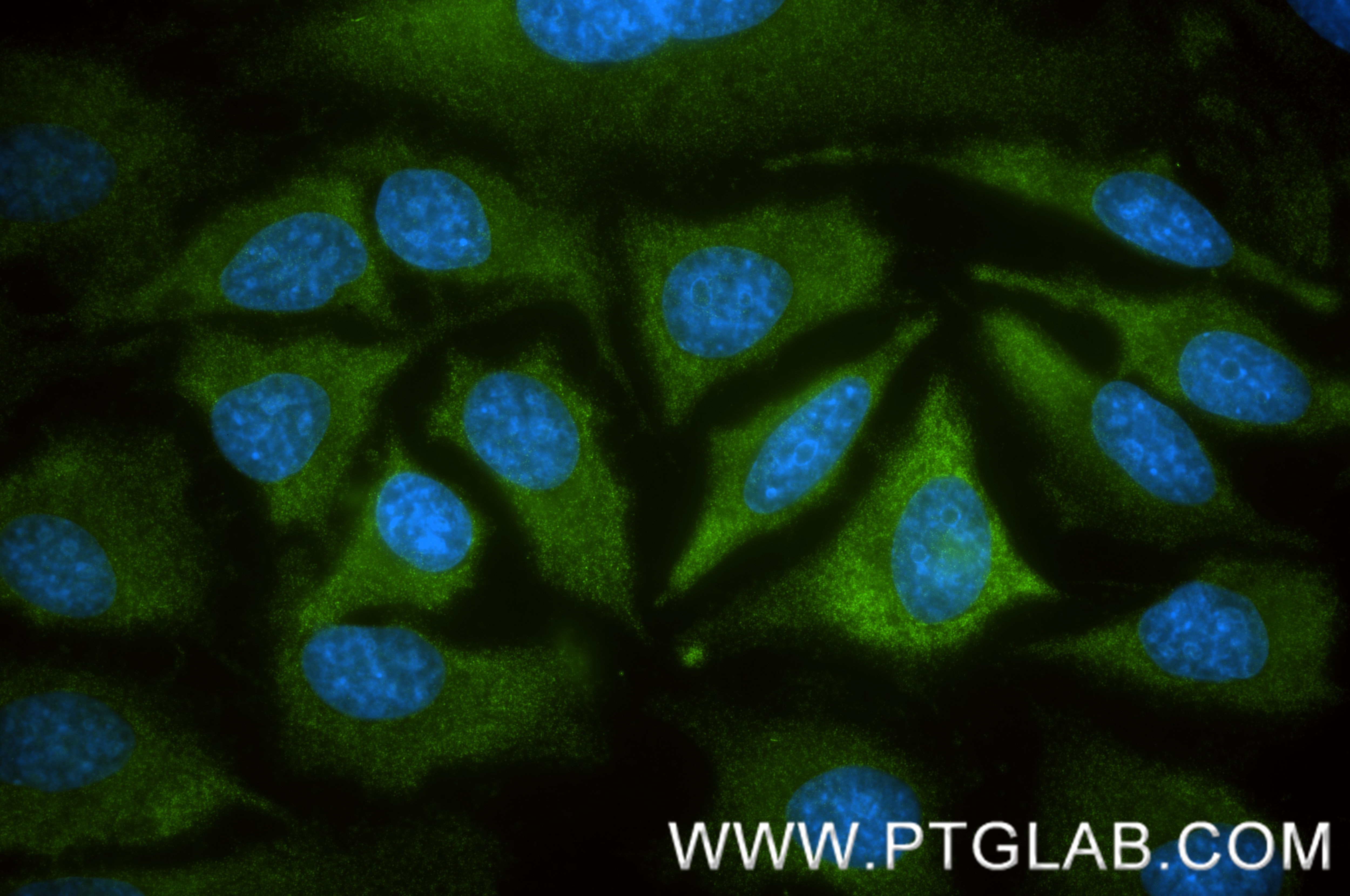 Immunofluorescence (IF) / fluorescent staining of HeLa cells using CTP synthase Recombinant monoclonal antibody (86455-1-RR)
