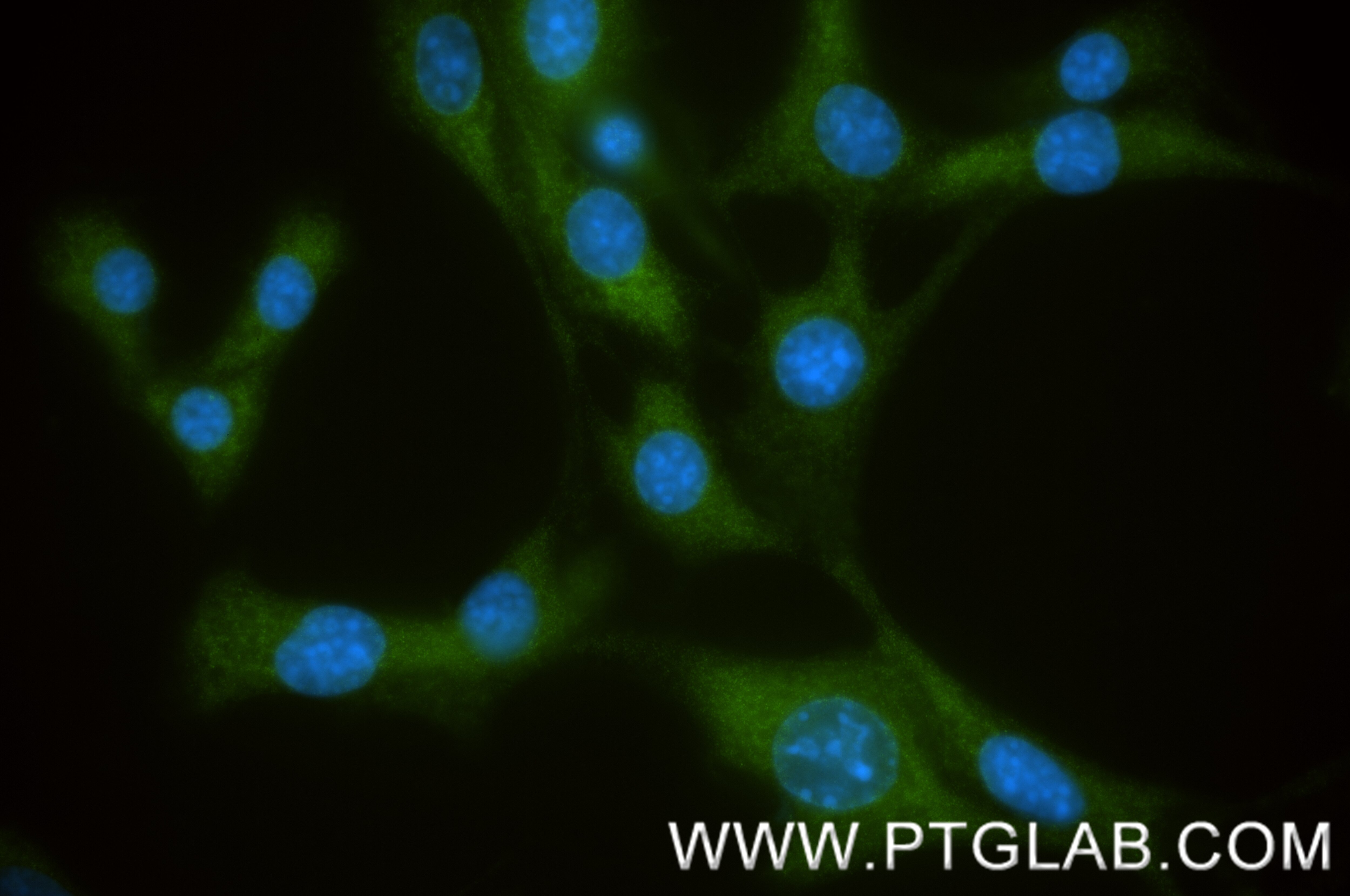 Immunofluorescence (IF) / fluorescent staining of NIH/3T3 cells using CTP synthase Recombinant monoclonal antibody (86455-1-RR)