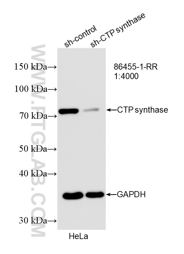 Western Blot (WB) analysis of HeLa cells using CTP synthase Recombinant monoclonal antibody (86455-1-RR)