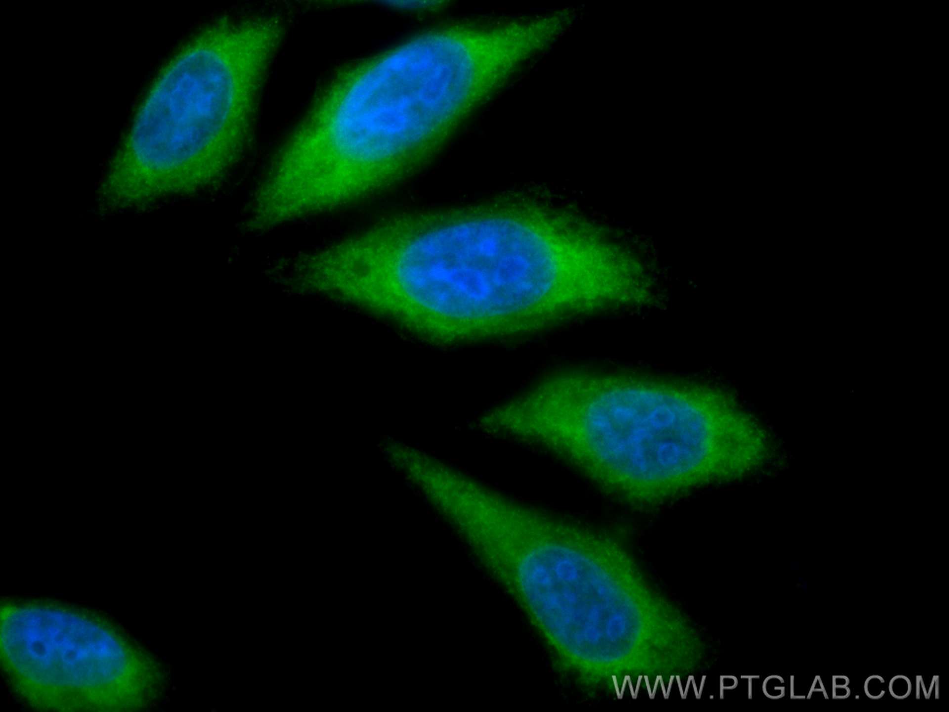 Immunofluorescence (IF) / fluorescent staining of HepG2 cells using CoraLite® Plus 488-conjugated CTP synthase Polyclo (CL488-15914)