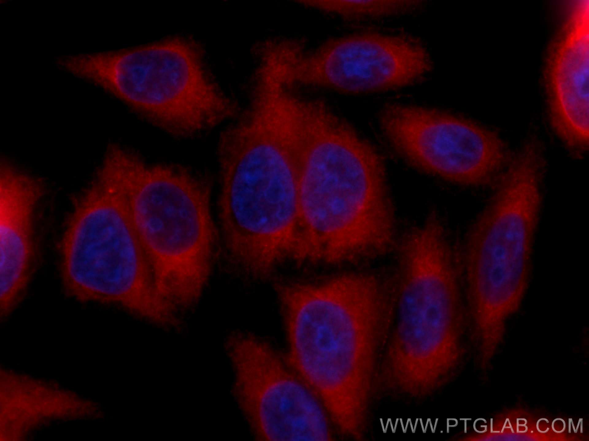 CTP synthase