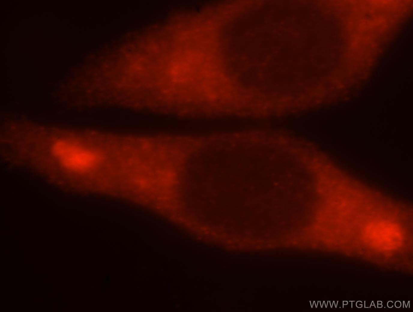 Immunofluorescence (IF) / fluorescent staining of HepG2 cells using CTP synthase Polyclonal antibody (15914-1-AP)