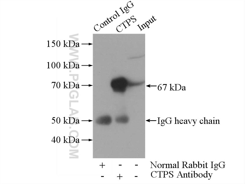 Immunoprecipitation (IP) experiment of HeLa cells using CTP synthase Polyclonal antibody (15914-1-AP)