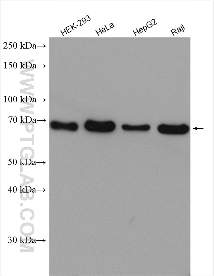 Western Blot (WB) analysis of various lysates using CTP synthase Polyclonal antibody (15914-1-AP)