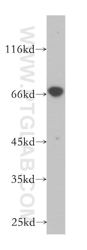 Western Blot (WB) analysis of HeLa cells using CTP synthase Polyclonal antibody (15914-1-AP)