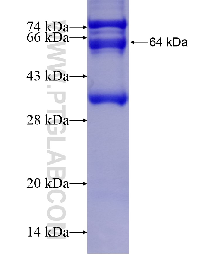 CTPS fusion protein Ag8707 SDS-PAGE