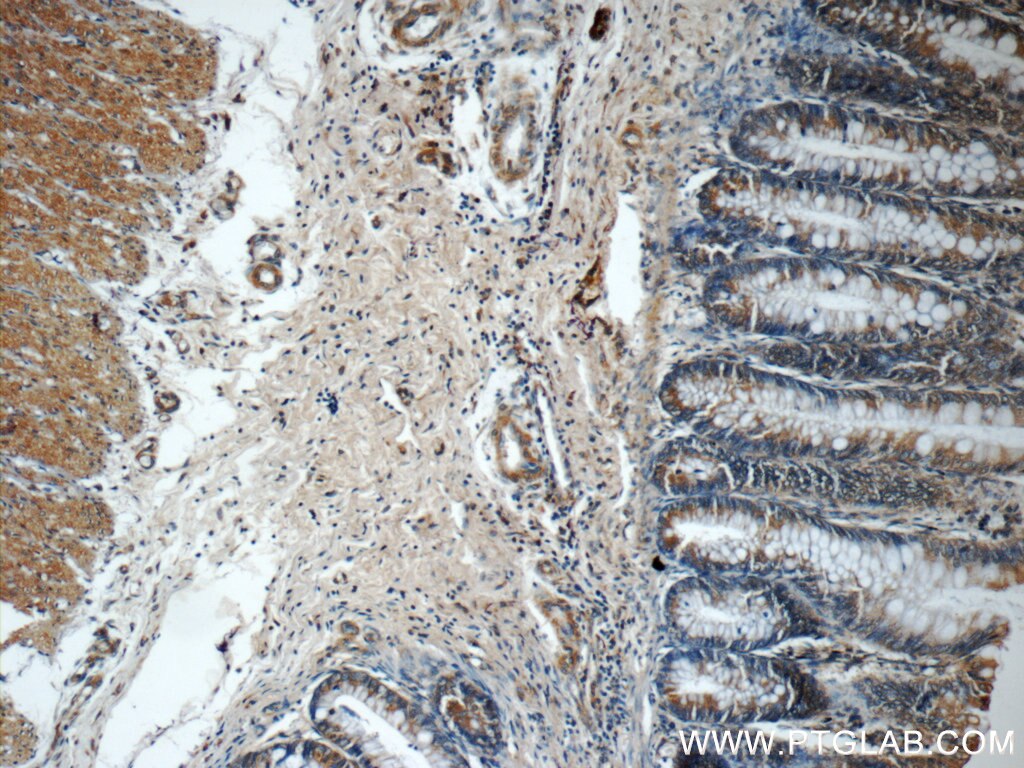 Immunohistochemistry (IHC) staining of human colon tissue using CTPS2 Polyclonal antibody (12852-1-AP)