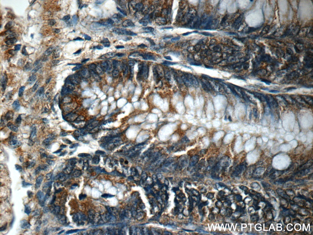 Immunohistochemistry (IHC) staining of human colon tissue using CTPS2 Polyclonal antibody (12852-1-AP)