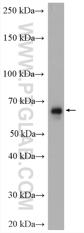 Western Blot (WB) analysis of mouse testis tissue using CTPS2 Polyclonal antibody (12852-1-AP)