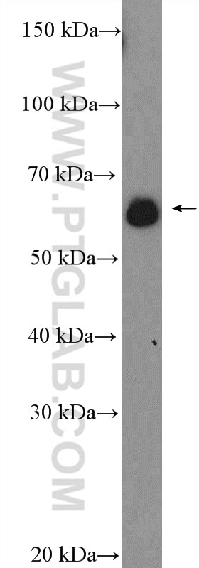 Western Blot (WB) analysis of HeLa cells using CTPS2 Polyclonal antibody (12852-1-AP)