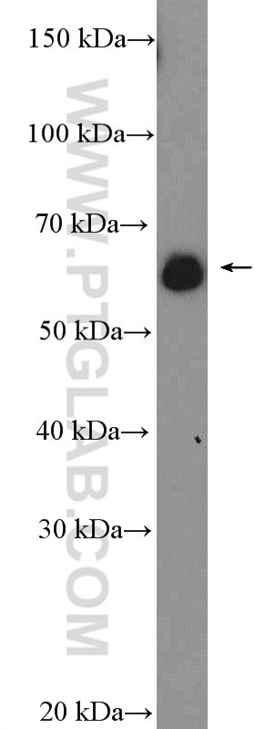 Western Blot (WB) analysis of HeLa cells using CTPS2 Polyclonal antibody (12852-1-AP)