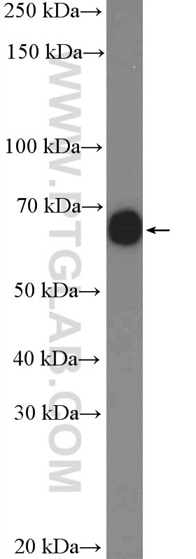 Western Blot (WB) analysis of mouse testis tissue using CTPS2 Polyclonal antibody (12852-1-AP)