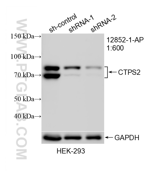 Western Blot (WB) analysis of HEK-293 cells using CTPS2 Polyclonal antibody (12852-1-AP)