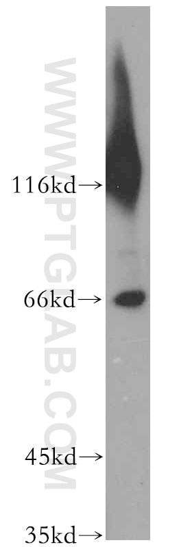 Western Blot (WB) analysis of human adrenal gland tissue using CTPS2 Polyclonal antibody (12852-1-AP)