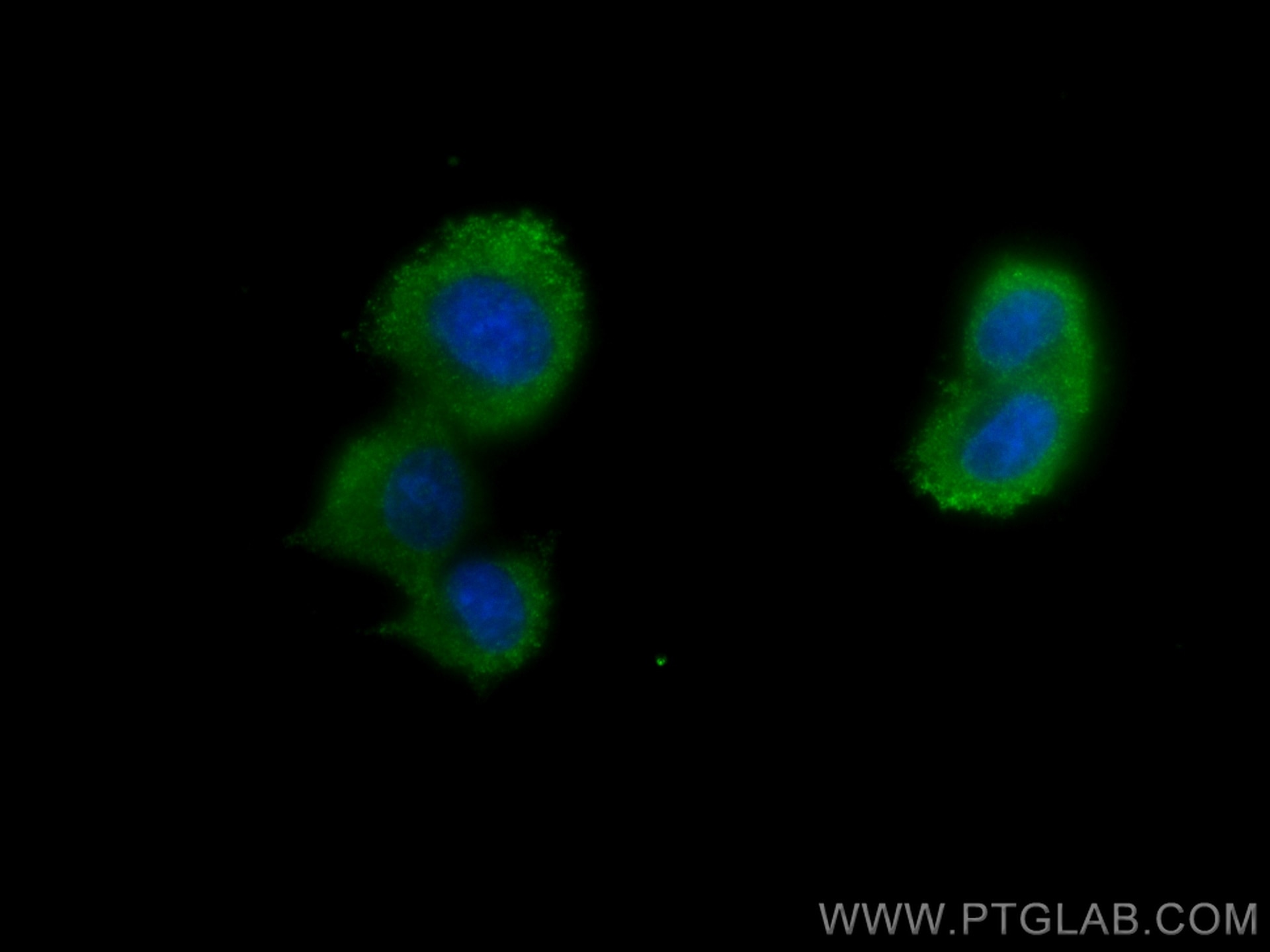 Immunofluorescence (IF) / fluorescent staining of PC-12 cells using CTPS2 Monoclonal antibody (67734-1-Ig)