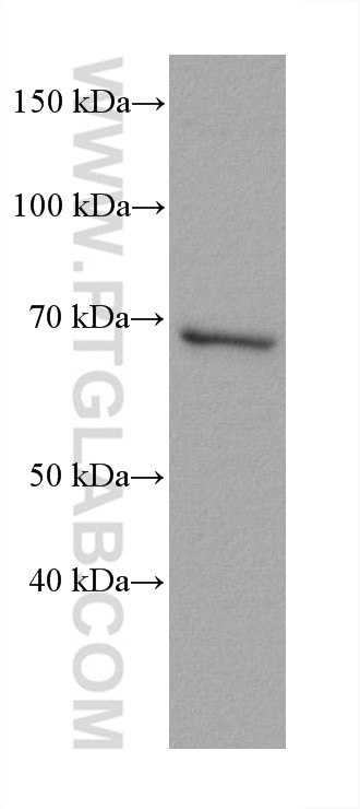 Western Blot (WB) analysis of U2OS cells using CTPS2 Monoclonal antibody (67734-1-Ig)