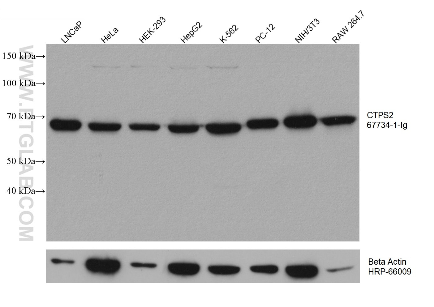 Western Blot (WB) analysis of various lysates using CTPS2 Monoclonal antibody (67734-1-Ig)