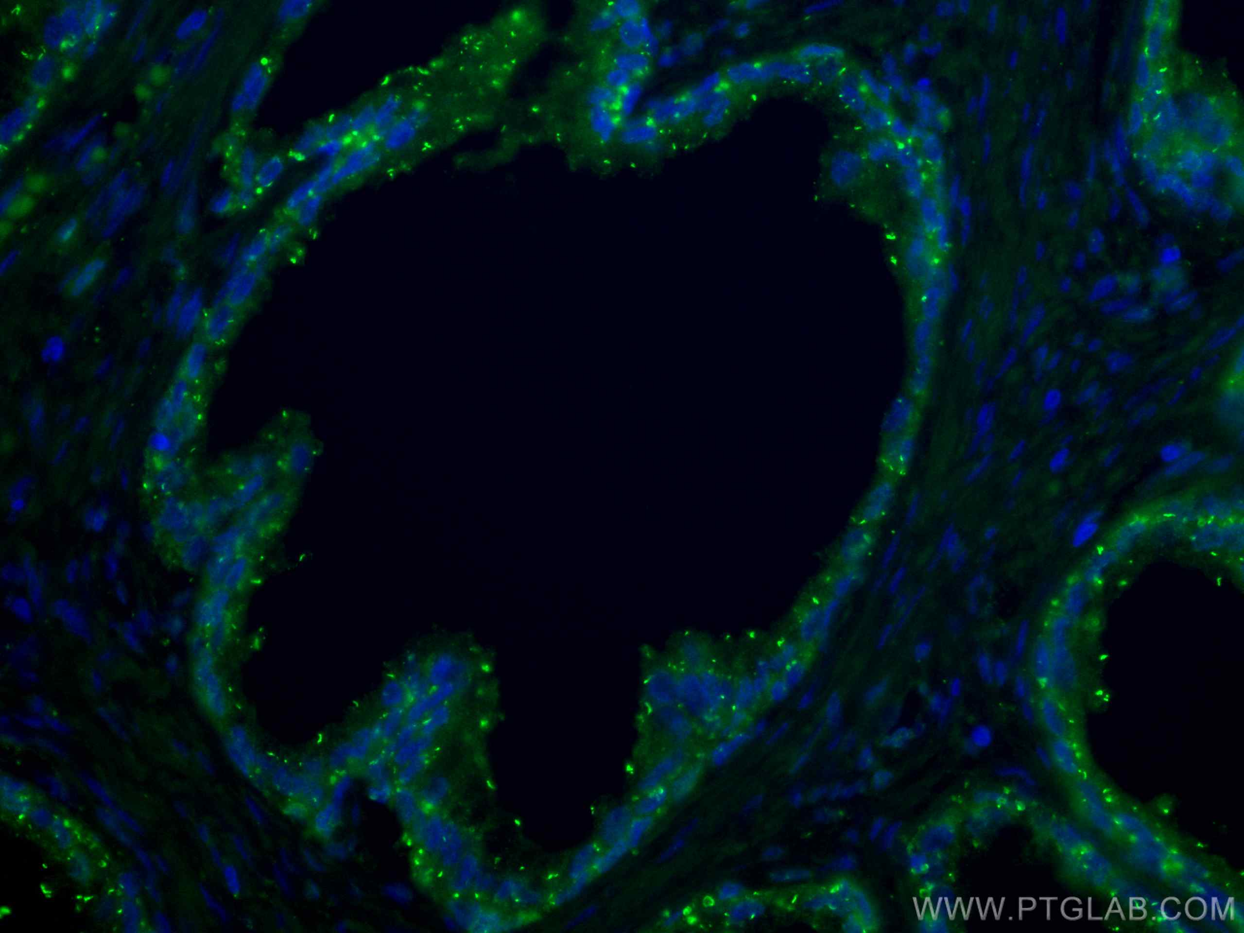 IF Staining of human prostate cancer using CL488-67734