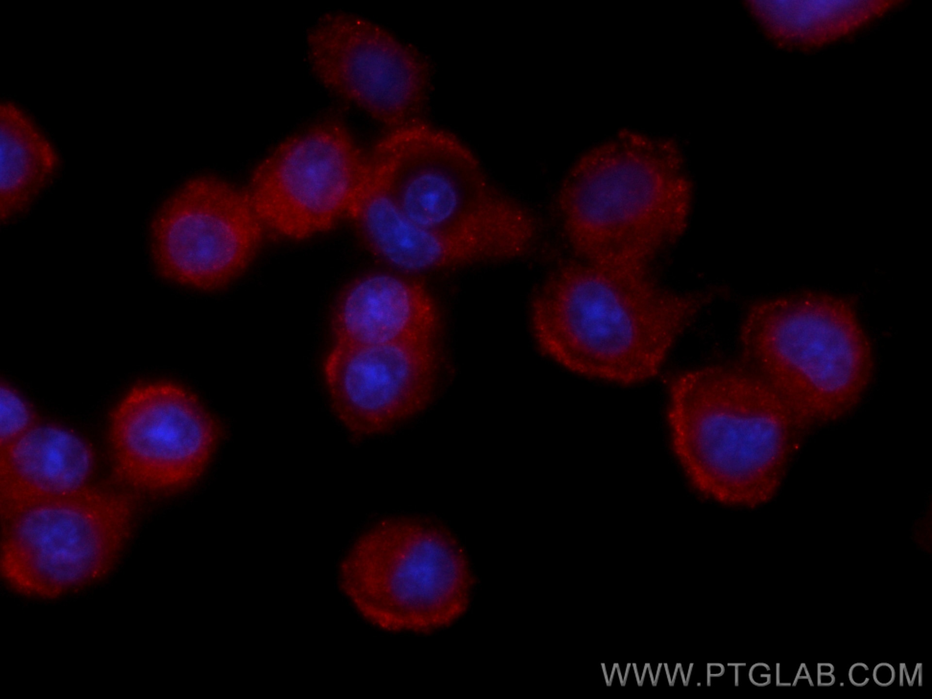 Immunofluorescence (IF) / fluorescent staining of PC-12 cells using CoraLite®594-conjugated CTPS2 Monoclonal antibody (CL594-67734)