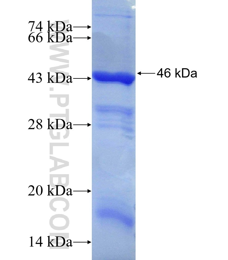 CTPS2 fusion protein Ag30258 SDS-PAGE