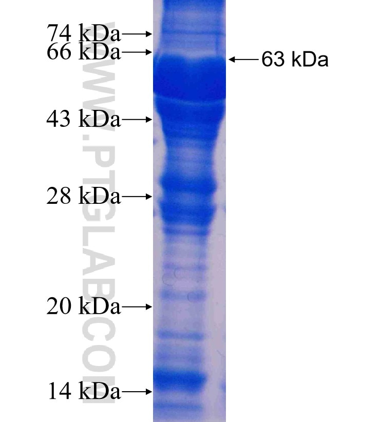 CTPS2 fusion protein Ag3490 SDS-PAGE
