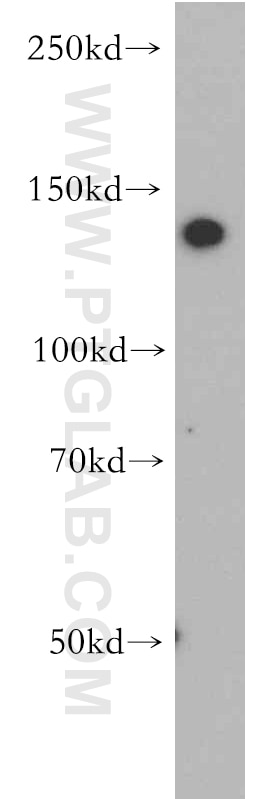 Western Blot (WB) analysis of HeLa cells using CTR9 Polyclonal antibody (20672-1-AP)