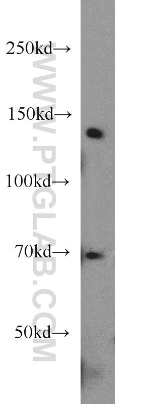 Western Blot (WB) analysis of HeLa cells using CTR9 Polyclonal antibody (20672-1-AP)