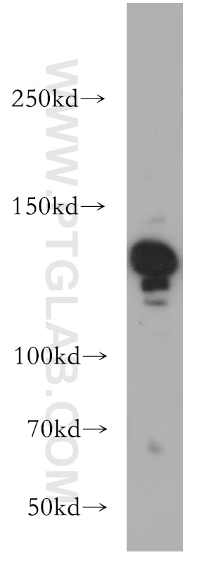 Western Blot (WB) analysis of HeLa cells using CTR9 Polyclonal antibody (21264-1-AP)