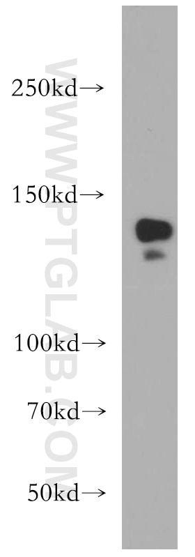 Western Blot (WB) analysis of HEK-293 cells using CTR9 Polyclonal antibody (21264-1-AP)