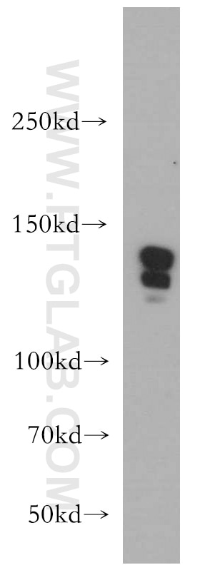 Western Blot (WB) analysis of L02 cells using CTR9 Polyclonal antibody (21264-1-AP)