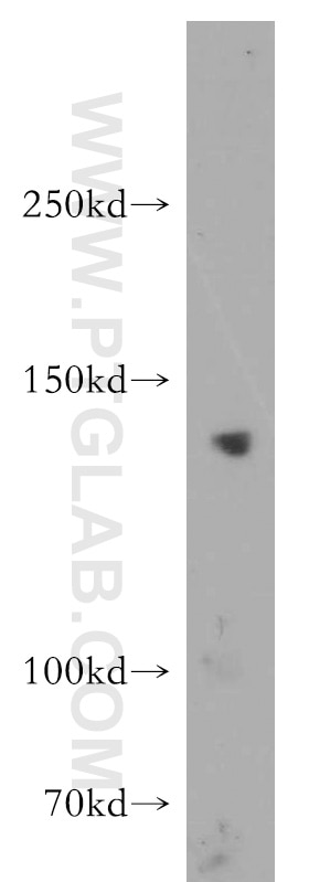 Western Blot (WB) analysis of mouse testis tissue using CTR9 Polyclonal antibody (21264-1-AP)