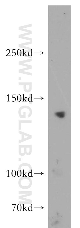 WB analysis of mouse testis using 21264-1-AP