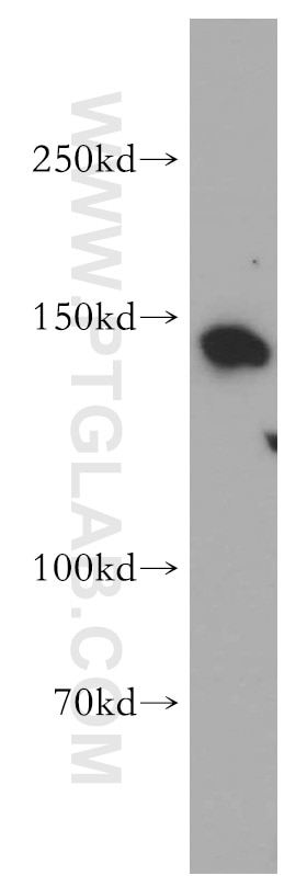 Western Blot (WB) analysis of Raji cells using CTR9 Polyclonal antibody (21264-1-AP)