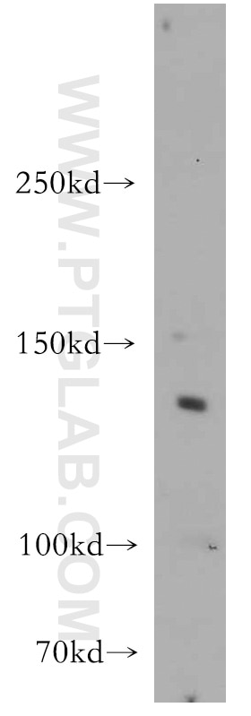 Western Blot (WB) analysis of mouse lung tissue using CTR9 Polyclonal antibody (21264-1-AP)