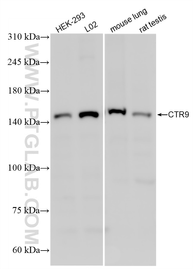 CTR9