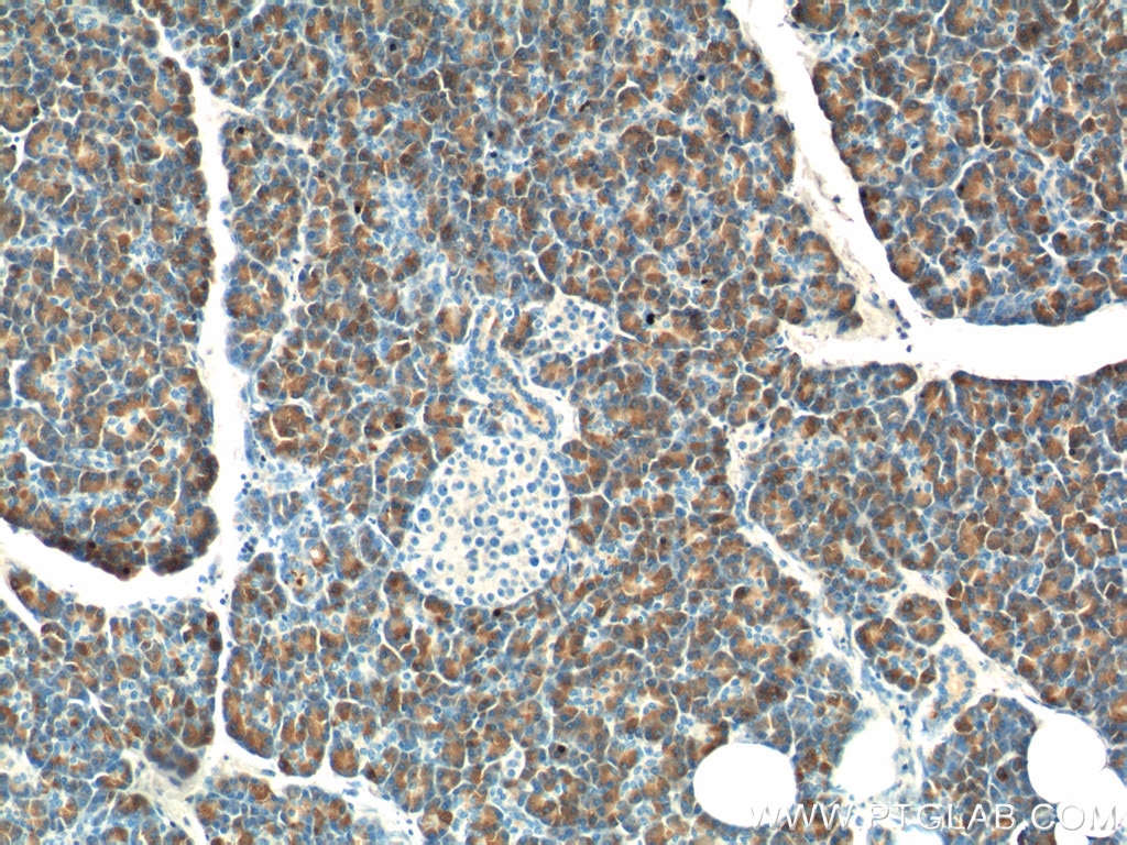 Immunohistochemistry (IHC) staining of human pancreas tissue using CTRB1 Polyclonal antibody (24939-1-AP)