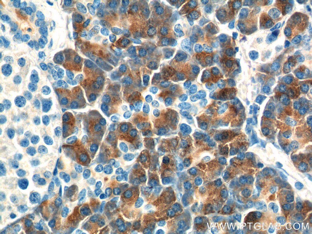 Immunohistochemistry (IHC) staining of human pancreas tissue using CTRB1 Polyclonal antibody (24939-1-AP)