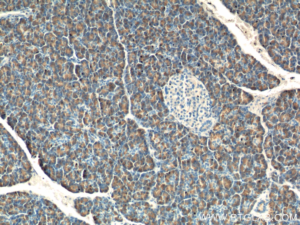 Immunohistochemistry (IHC) staining of human pancreas tissue using CTRB1 Polyclonal antibody (24939-1-AP)
