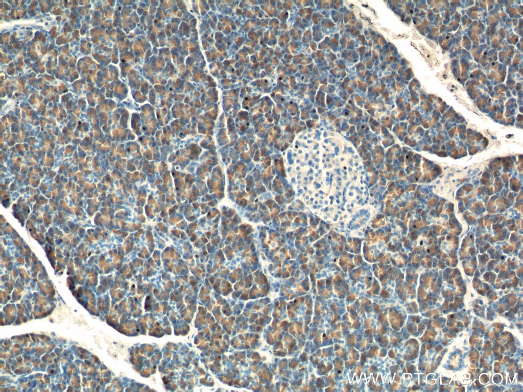 IHC staining of human pancreas using 24939-1-AP