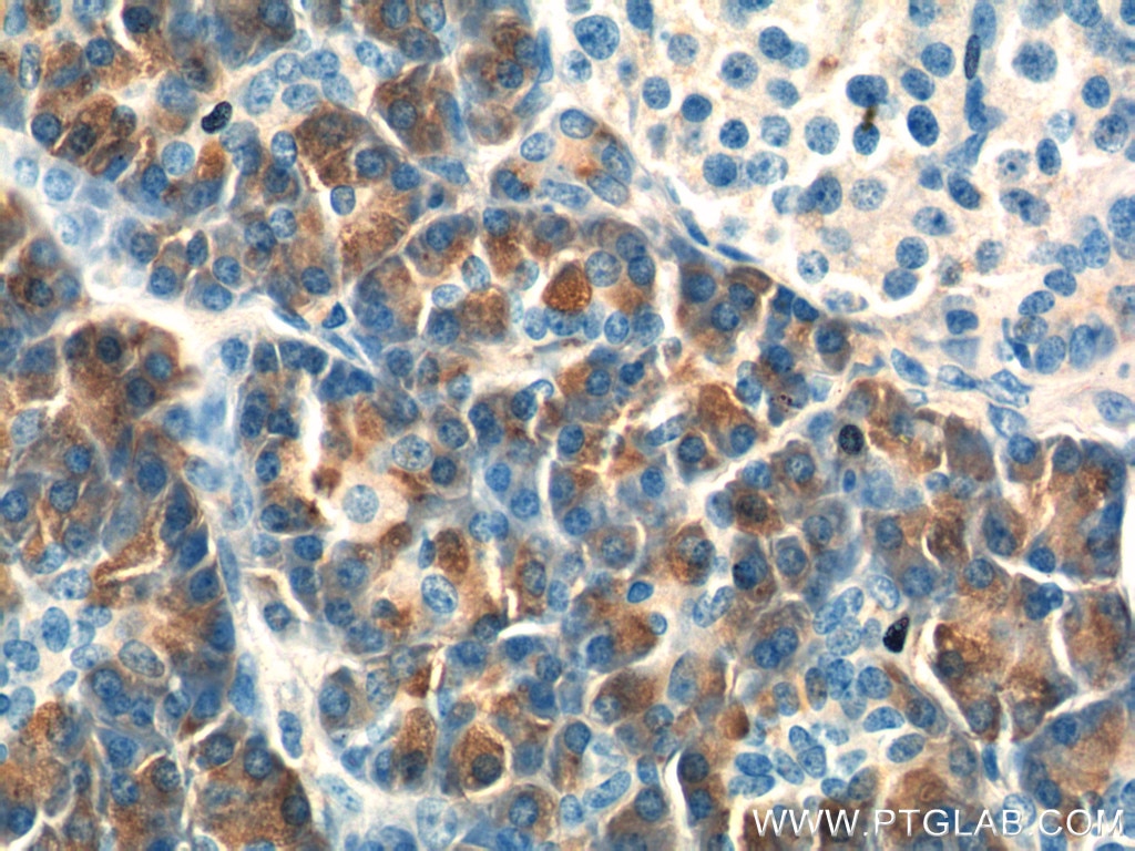 Immunohistochemistry (IHC) staining of human pancreas tissue using CTRB1 Polyclonal antibody (24939-1-AP)