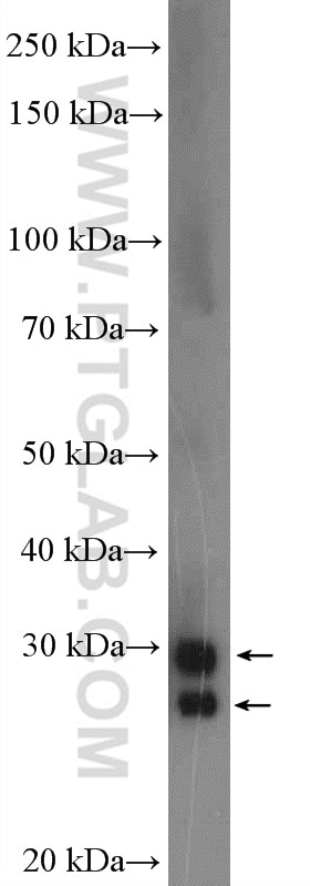 Western Blot (WB) analysis of mouse pancreas tissue using CTRB1 Polyclonal antibody (24939-1-AP)