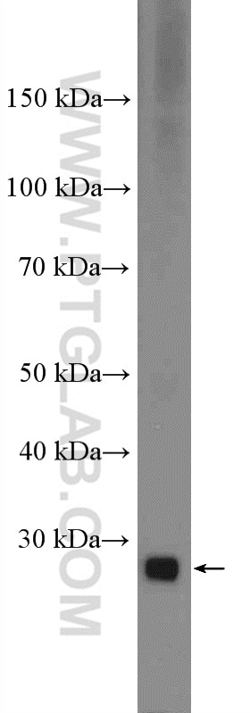 WB analysis of mouse pancreas using 24939-1-AP