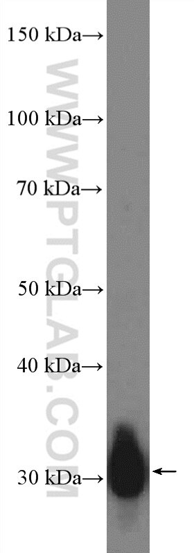 WB analysis of rat pancreas using 24939-1-AP