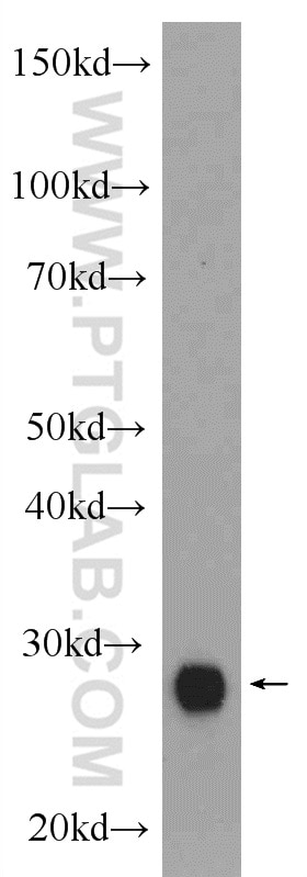 Western Blot (WB) analysis of rat pancreas tissue using CTRB1 Polyclonal antibody (24939-1-AP)