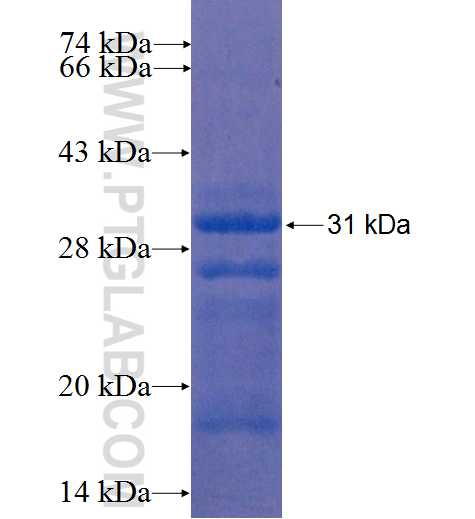 CTRB1 fusion protein Ag8820 SDS-PAGE