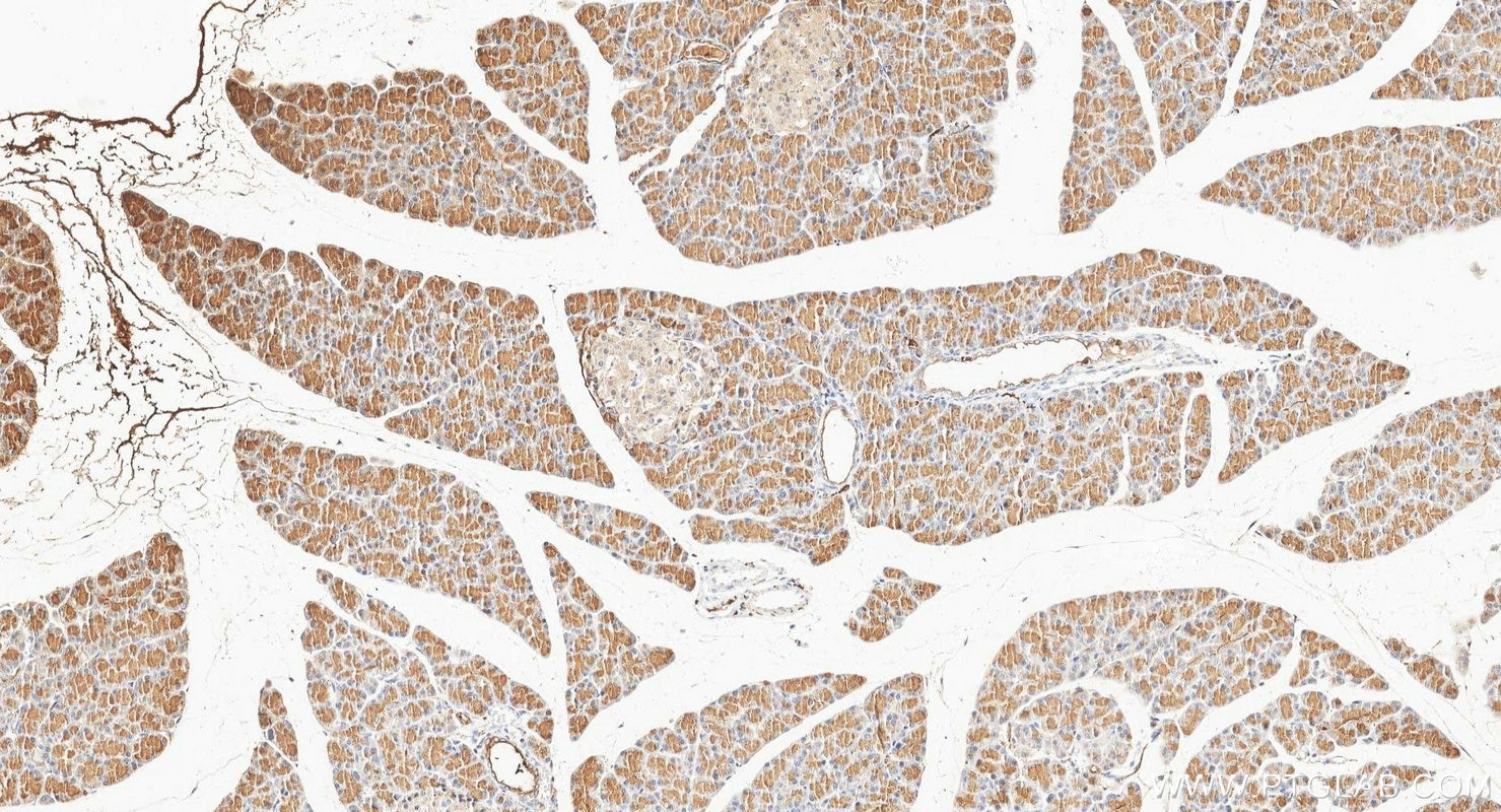 IHC staining of rat pancreas using 16416-1-AP Immunohistochemistry (IHC) staining of rat pancreas tissue using Chymotrypsin C Polyclonal antibody (16416-1-AP)