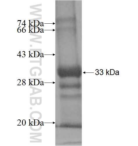 CTRC fusion protein Ag9594 SDS-PAGE