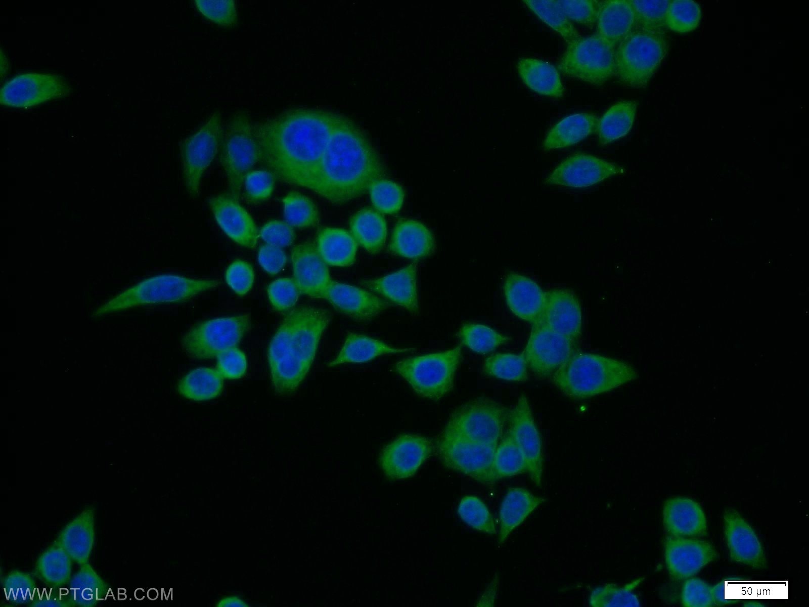 Immunofluorescence (IF) / fluorescent staining of BxPC-3 cells using CTRL Polyclonal antibody (14856-1-AP)