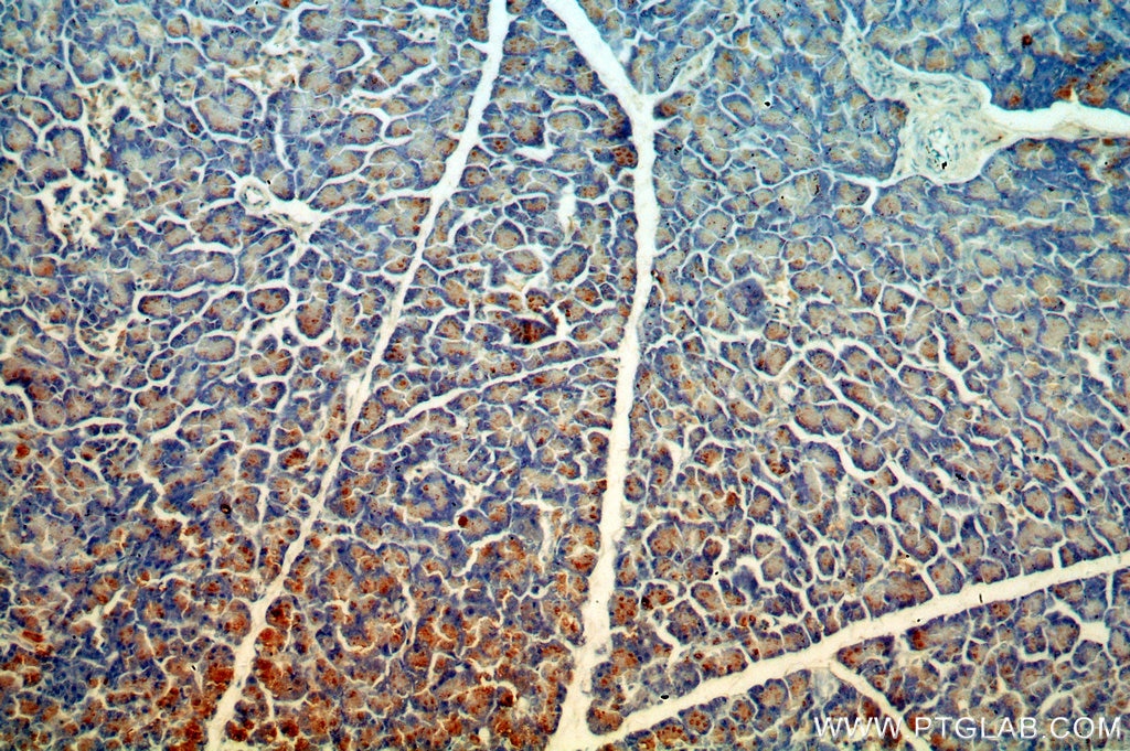 Immunohistochemistry (IHC) staining of human pancreas tissue using CTRL Polyclonal antibody (14856-1-AP)